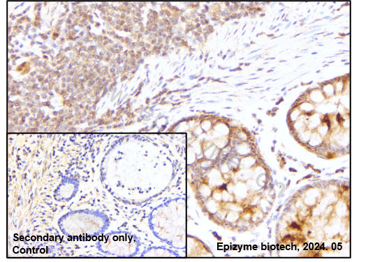Anti-Smad2/3 Rabbit mAb [14L86C22]