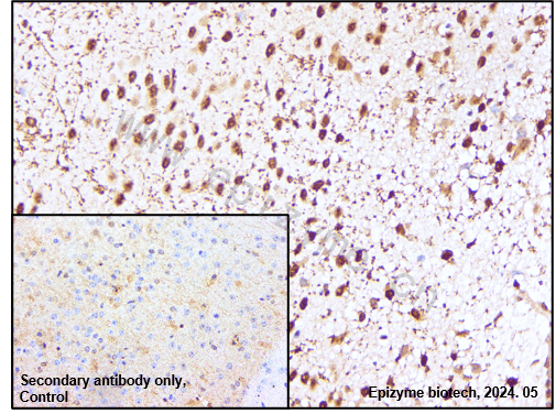 Anti-Smad2/3 Rabbit mAb [14L86C22]