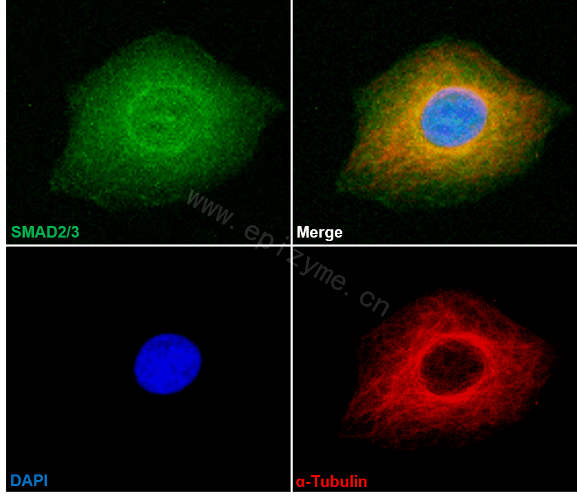 Anti-Smad2/3 Rabbit mAb [14L86C22]